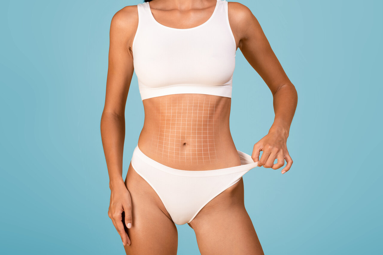 Perdeu muito peso Veja como a lipoabdominoplastia pode beneficiar sua transformação!